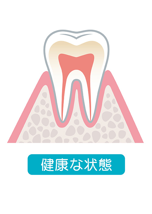 健康な状態の歯